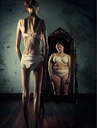 anorexia